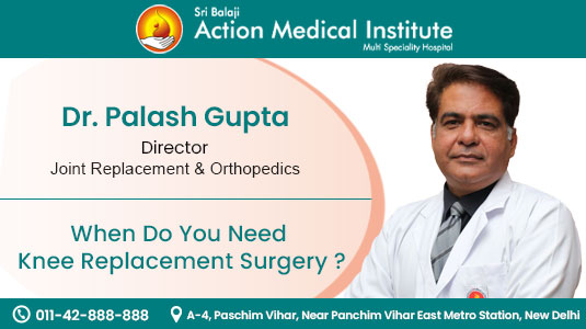 When Do You Need Knee Replacement Surgery?
