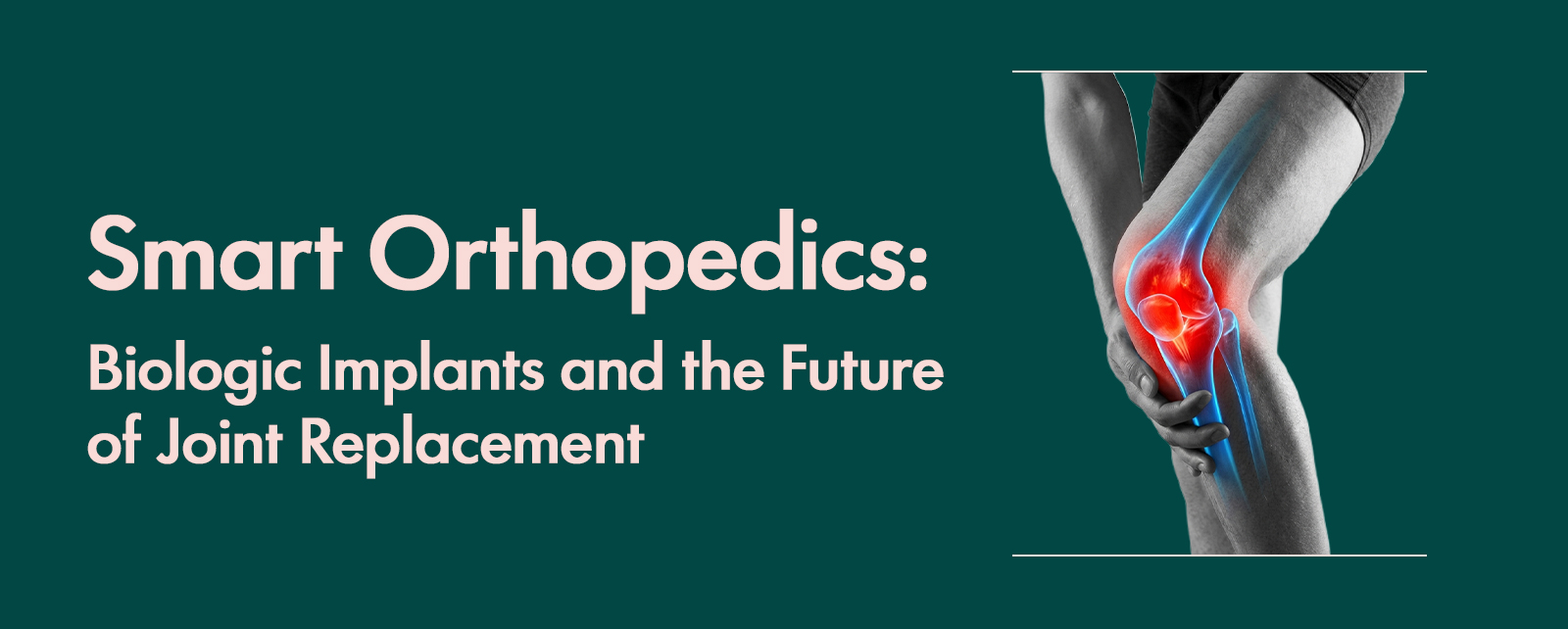 Smart Orthopedics: Biologic Implants and the Future of Joint Replacement