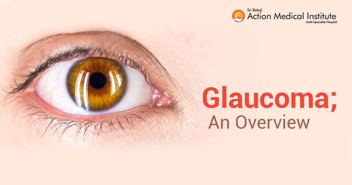 Glaucoma - An Overview
