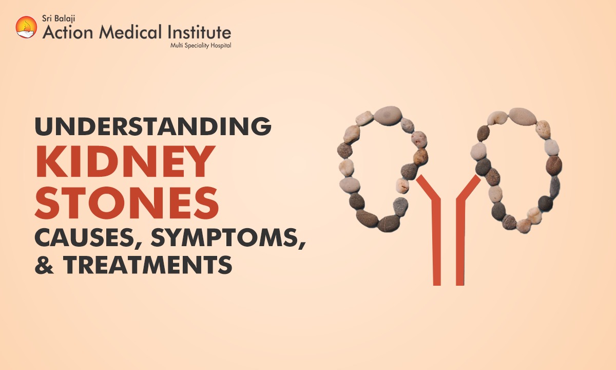 Understanding Kidney Stones: Causes, Symptoms, & Treatments