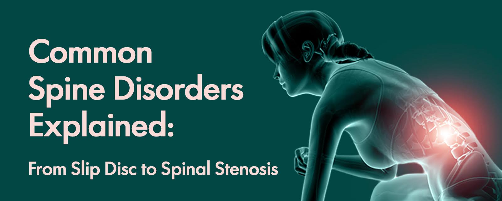 Common Spine Disorders Explained: From Slip Disc to Spinal Stenosis