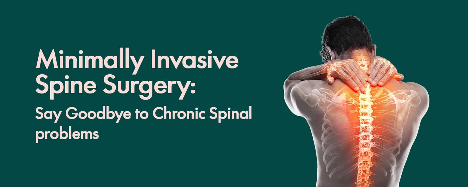 Minimally Invasive Spine Surgery: Say Goodbye to Chronic  Spinal problems