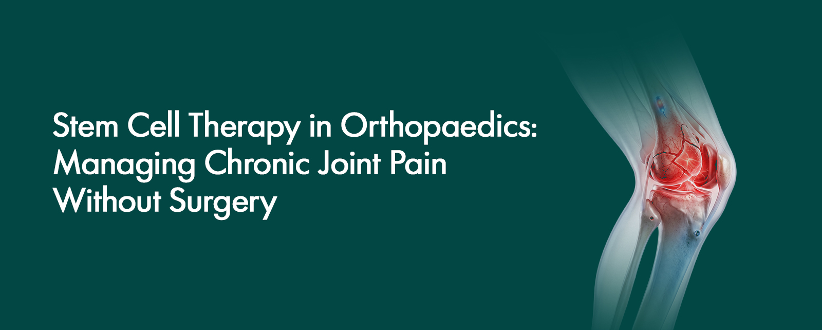 Stem Cell Therapy in Orthopaedics: Managing Chronic Joint Pain Without Surgery
